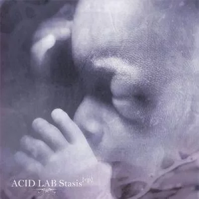 Acid Lab
