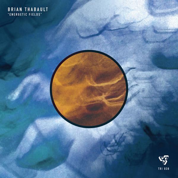 Brian Thabault