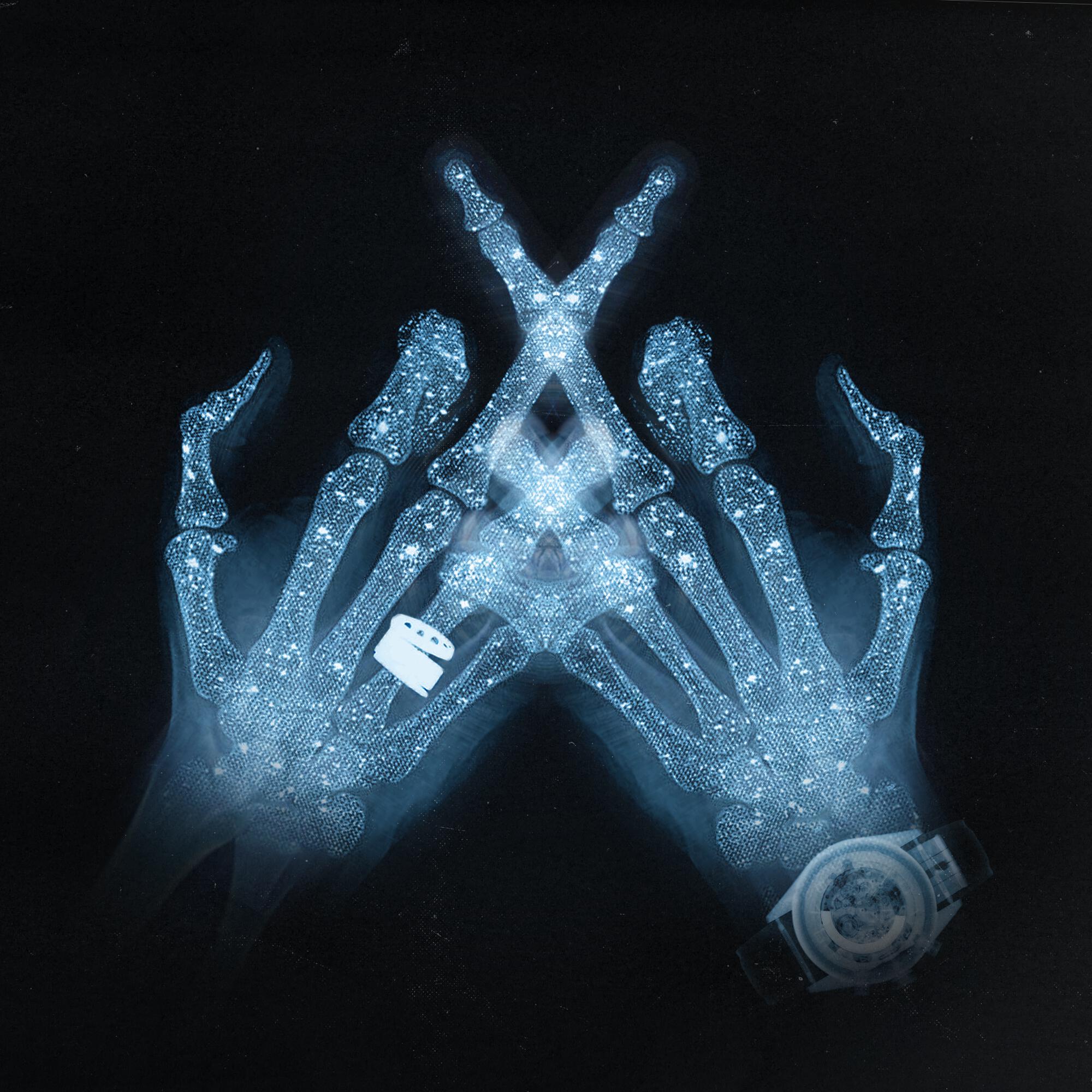 X-RAY