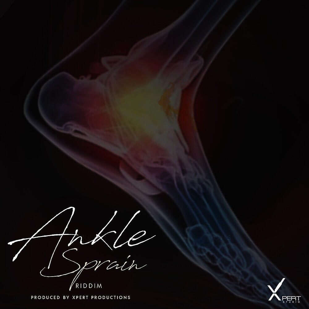 Ankle Sprain Riddim