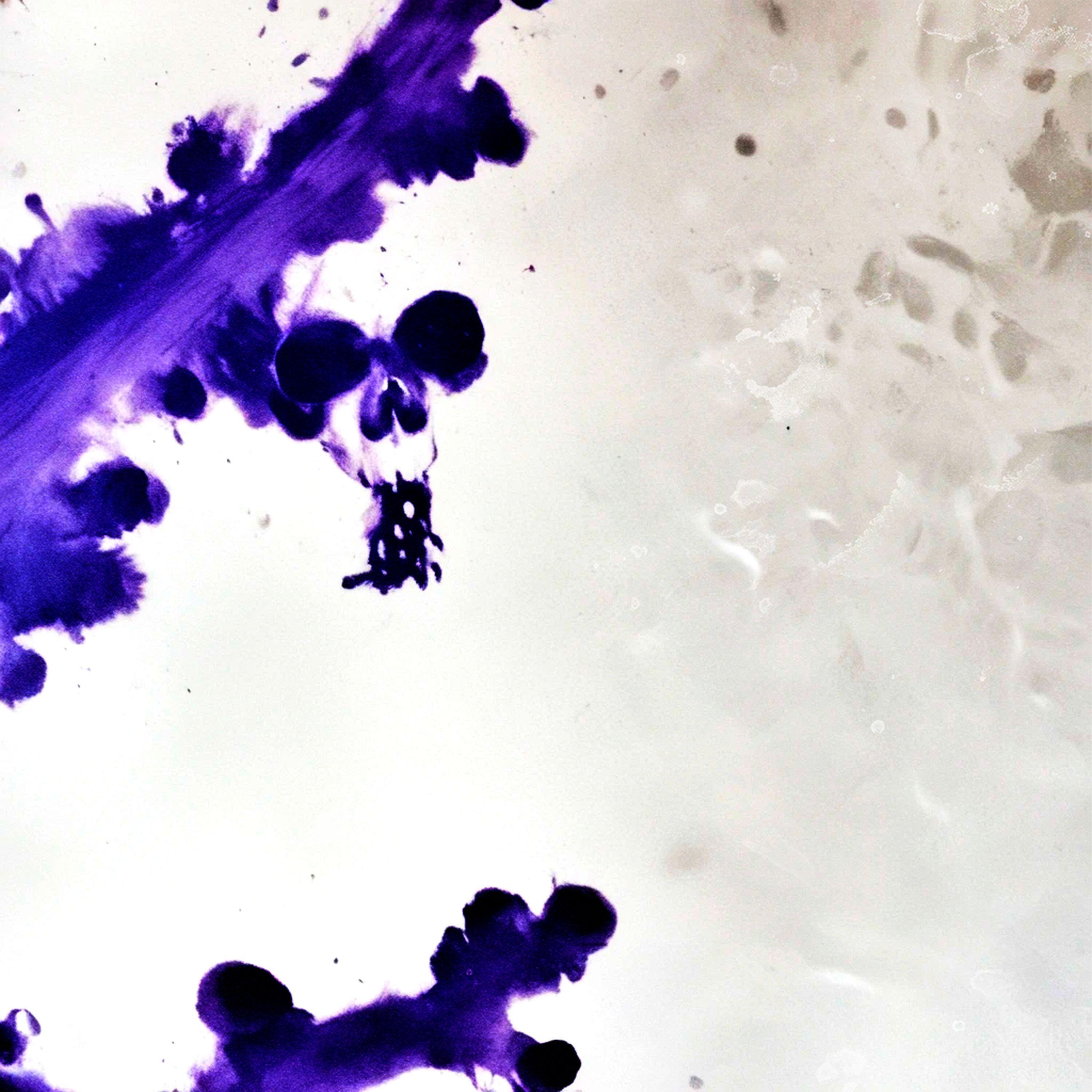 Atrophy